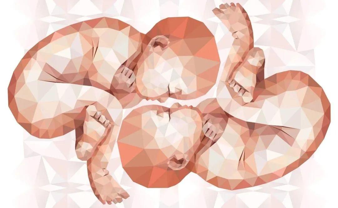 新冠肺炎双胞胎实验研究表明新冠肺炎的症状与遗传密切相关