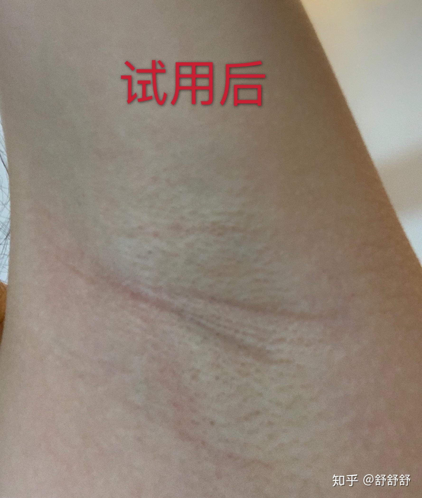 v2-7b3c32f2b9af0299dcbd5d43f5915b57_r.jpg