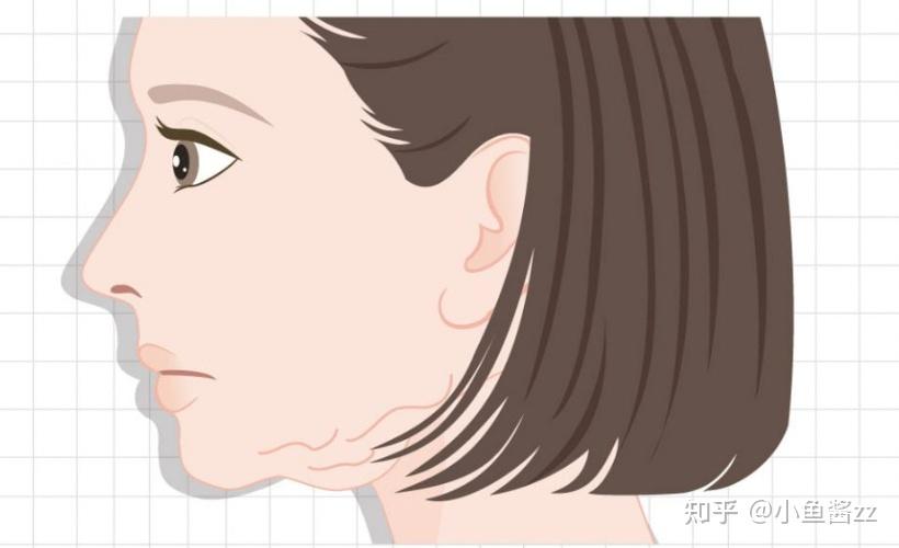 韩国医美下颌线雕刻术韩国新潮流一招打造紧致清晰的下颌线完美侧颜杀