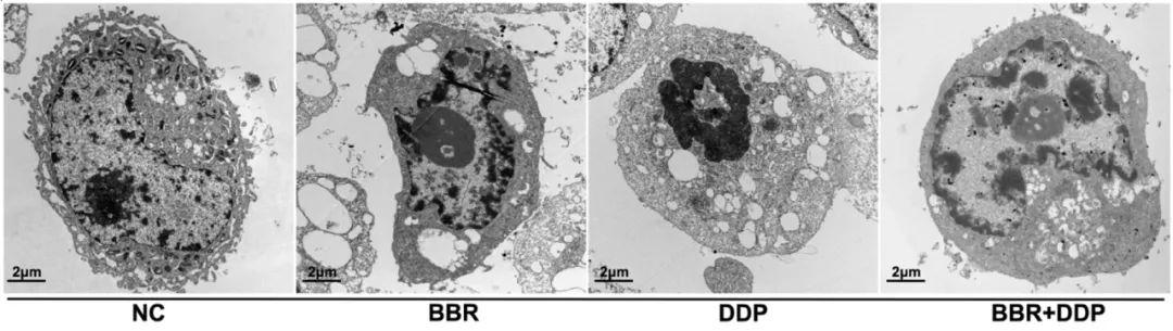 细胞凋亡——如何检测？| MedChemExpress - 知乎