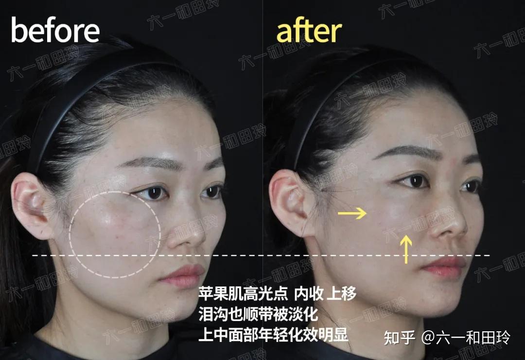 "诶?打乔雅登的抗老效果好好哦"