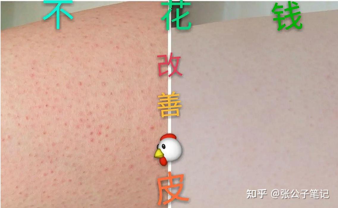 吸完奶浑身起鸡皮疙瘩(吸完奶浑身起鸡皮疙瘩怎么回事)