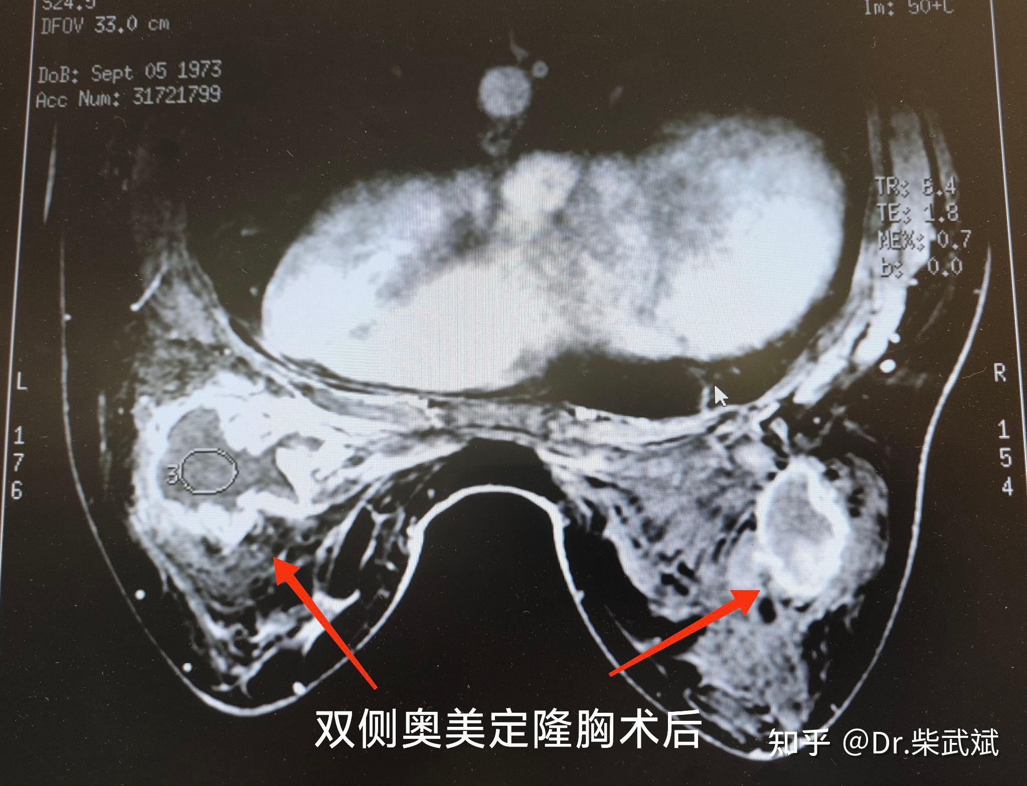 奥美定发炎照片图片