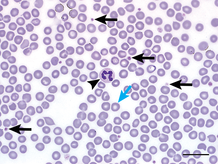 临床病理学图谱血涂片中红细胞判读