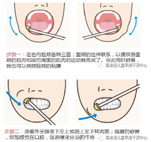 发育迟缓儿童口肌训练实用方法