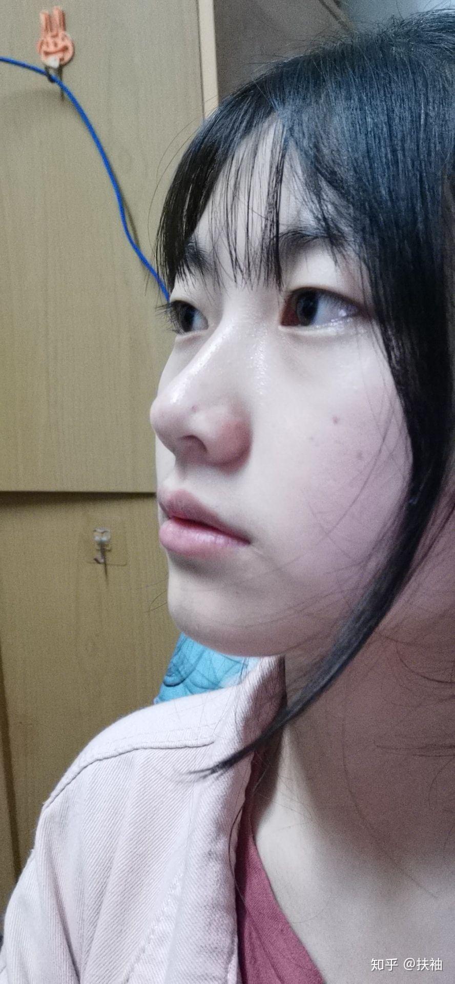 正脸正常,侧脸丑到爆是什么体验? - 知乎