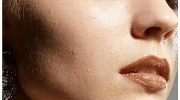 如何改善皮肤发黄暗沉