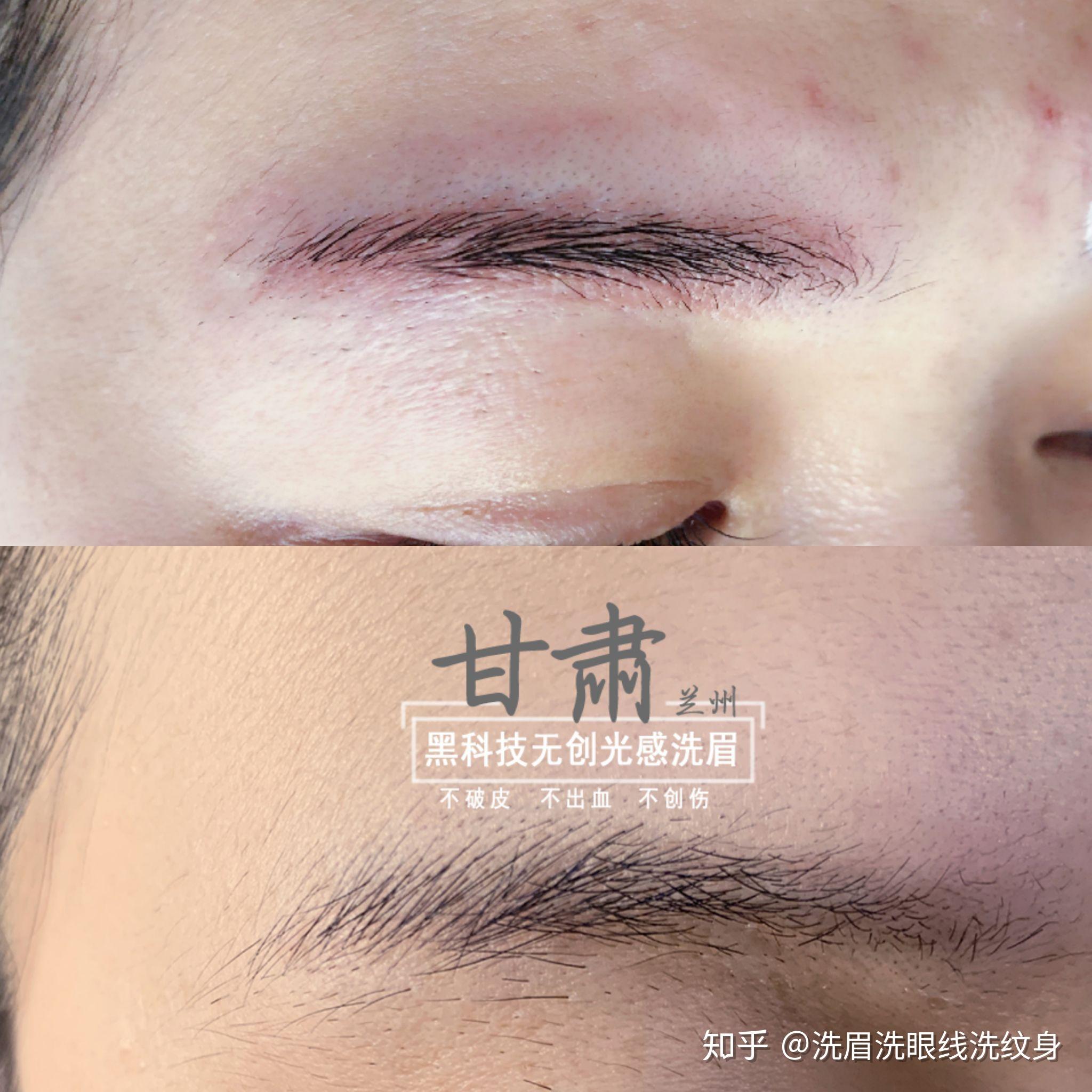 褪色了怎么办,过时了怎么办无创洗眉毛洗眼线洗纹身洗眉洗眼线洗纹身