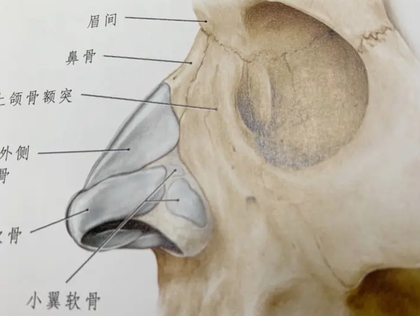 鼻骨内推是通往高颜值的必经之路 知乎