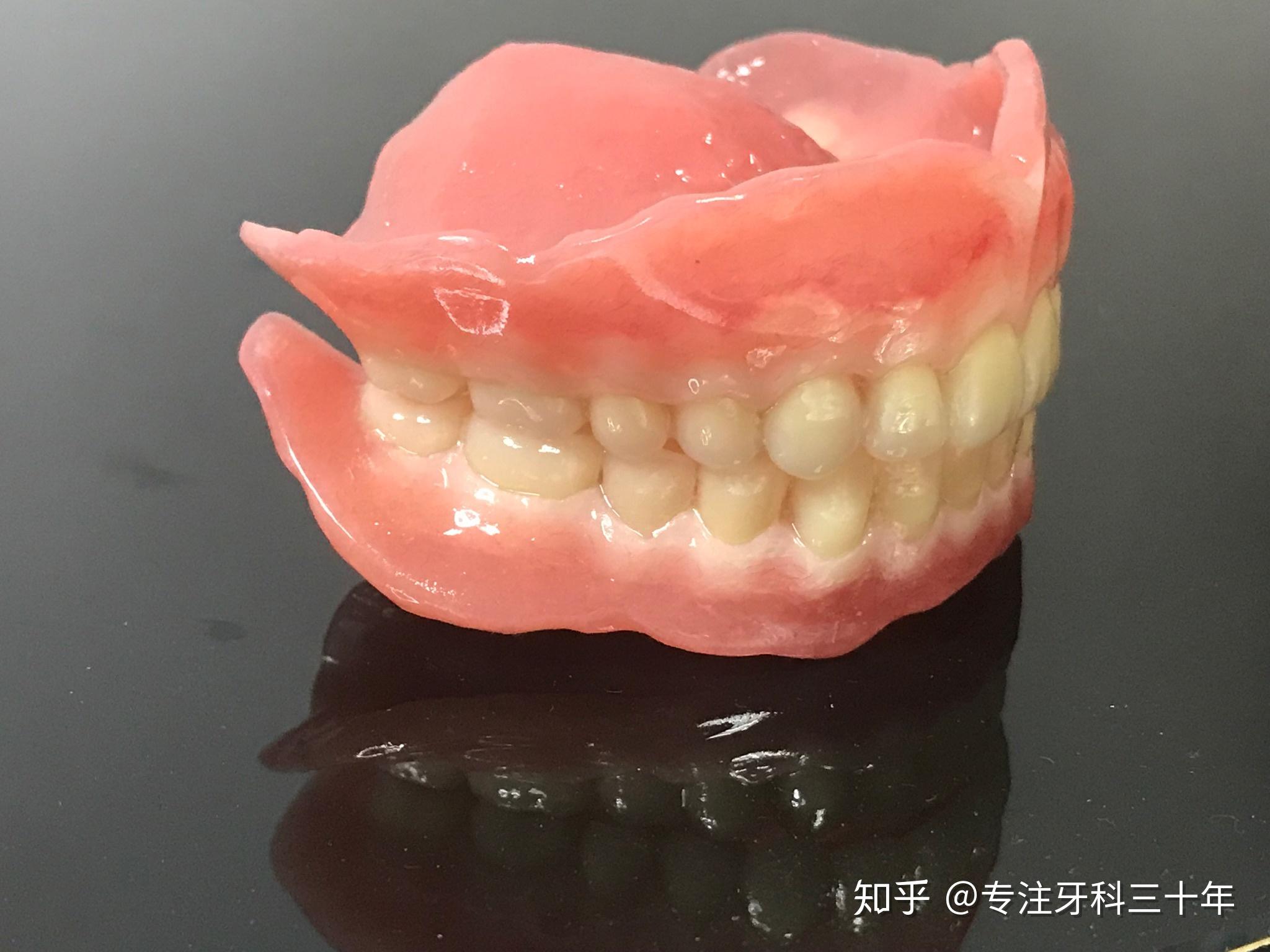 长正中吸附性全口义齿