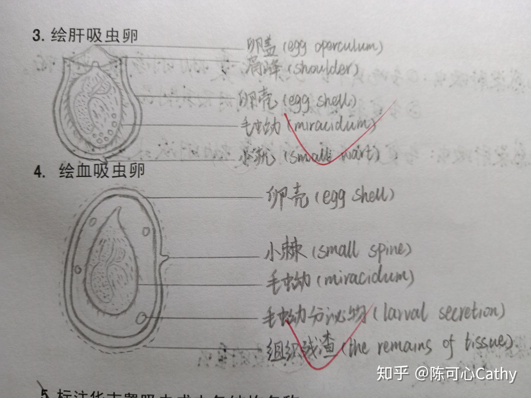 弓形虫滋养体红蓝铅笔图片