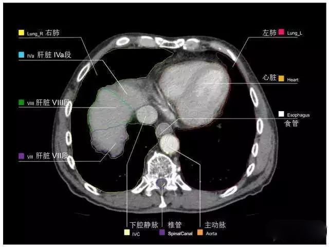 外科医生阅片能力:看完它,再也没有看不懂的腹部CT - 知乎
