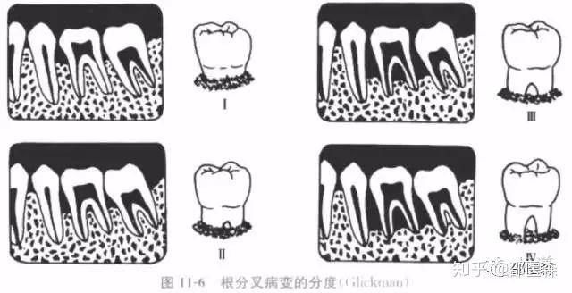 口腔规培考试重点(本人整理得巨细) - 知乎