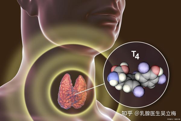 甲减一般怎样确诊？ - 知乎