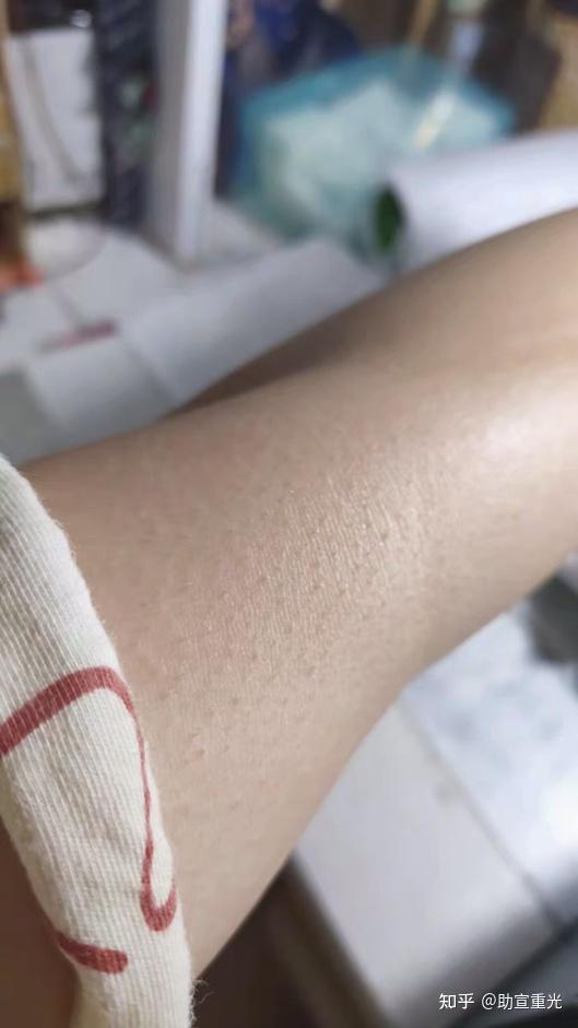 拒绝踩雷!脱毛仪双十二特更篇