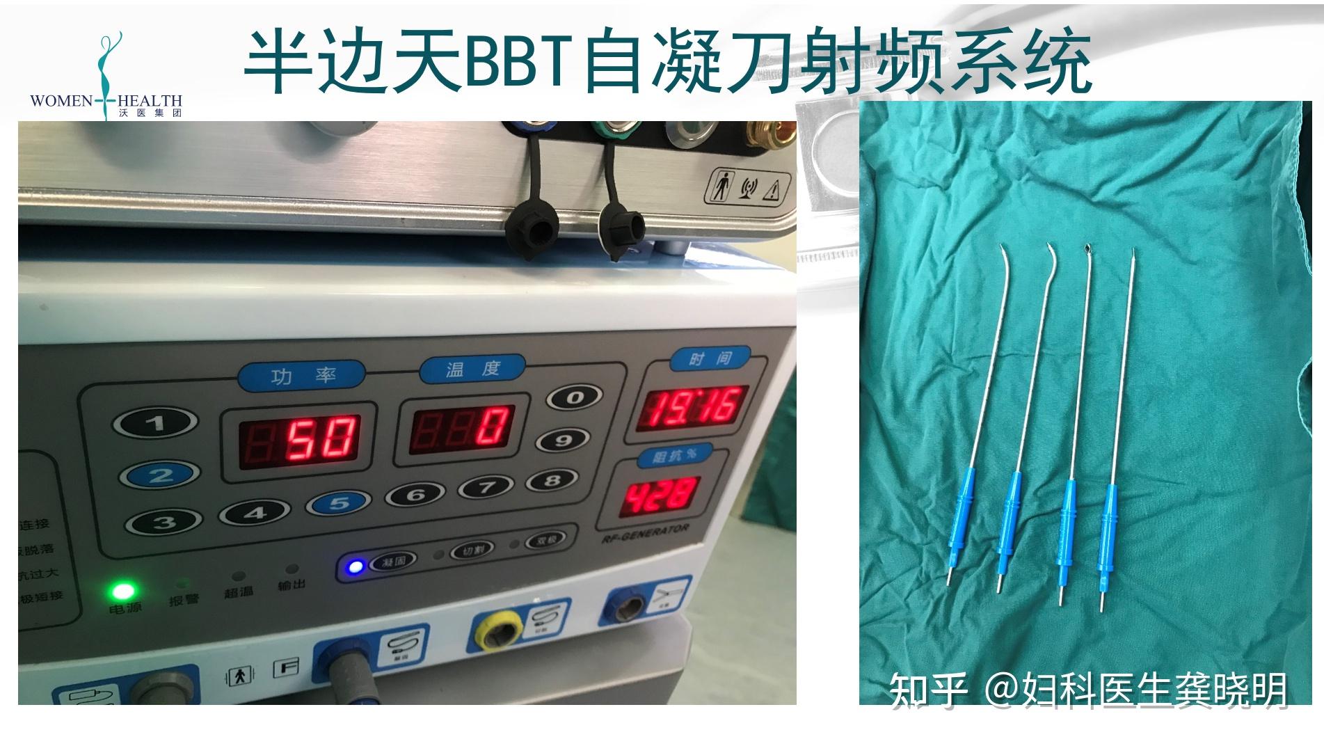 一种不切子宫不再让月经来的高科技 - 知乎
