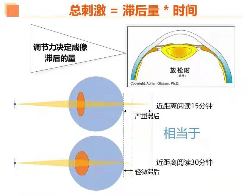 防控近视中调节力训练的原理和重要性 - 知乎