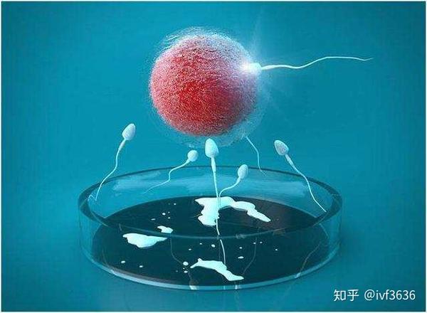 试管婴儿胚胎移植后肚子痛是正常的吗 知乎 试管婴儿胚胎移植后肚子痛是正常的吗 知乎