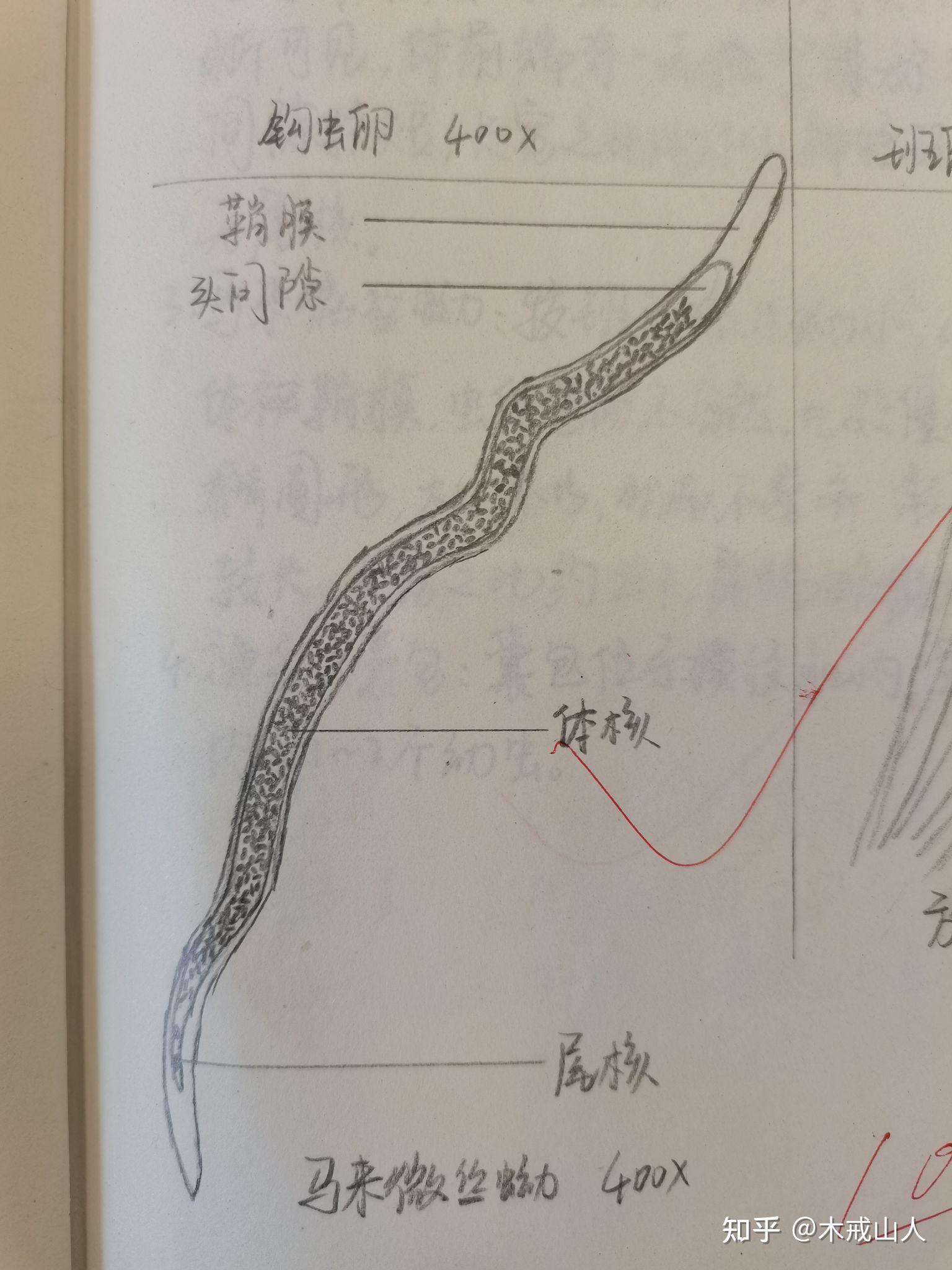 十二指肠钩虫手绘图片