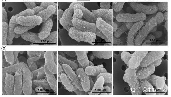 jextracellvesicl肠道病毒破坏菌群胞外囊泡