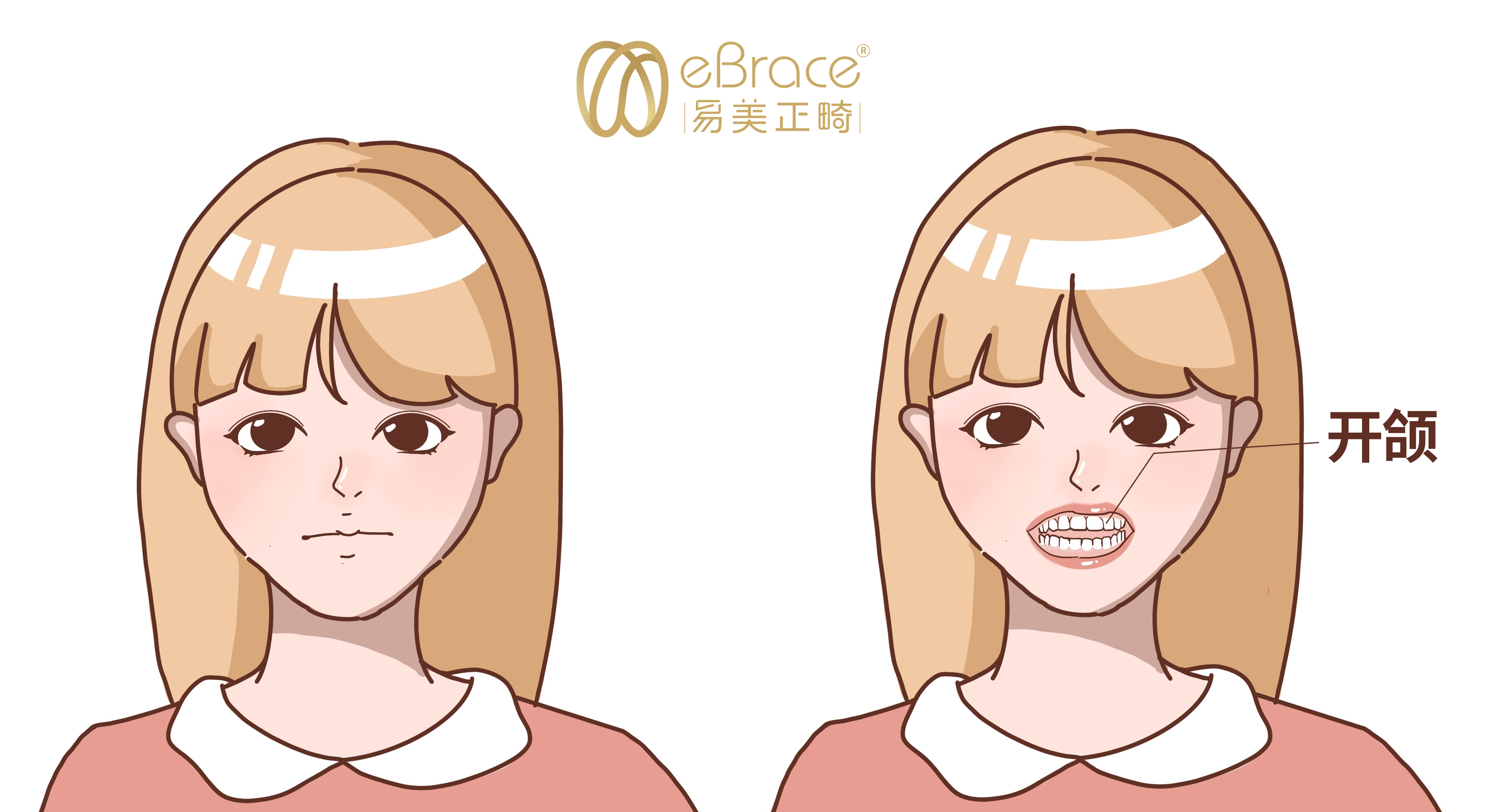 乘风破浪的姐姐拍了拍你别让不安分的牙齿兴风作浪