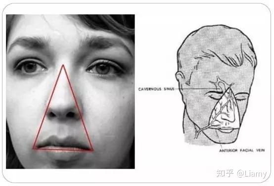 三角嘴是什么样子图片