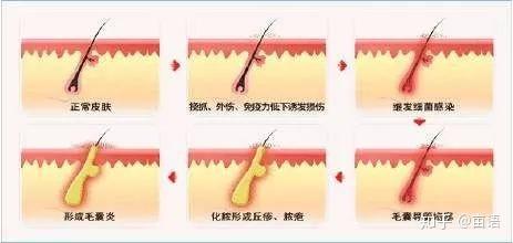 头发太长会和身体抢营养吗