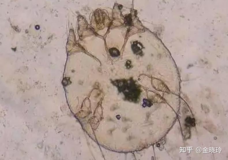 8款网红除螨皂大测评!除螨皂究竟有效,还是我们交了智商税? - 知乎