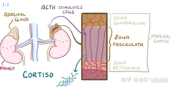医学科普之库欣综合征Cushing Syndrome - 知乎