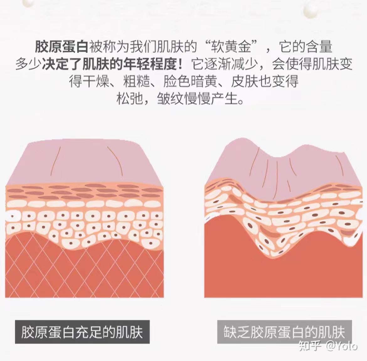 【皮肤科医生】从专业角度看,消除法令纹最快最有效的方法是什么? - 知乎