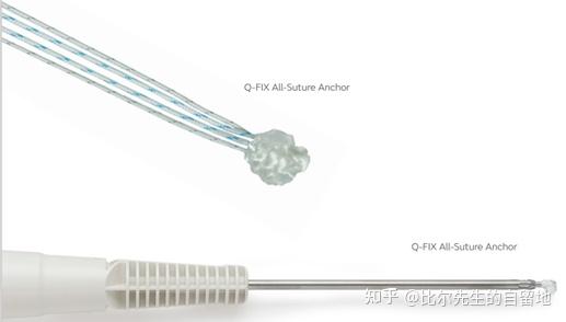 关节镜手术中绕不开的植入物-锚钉(四) - 知乎
