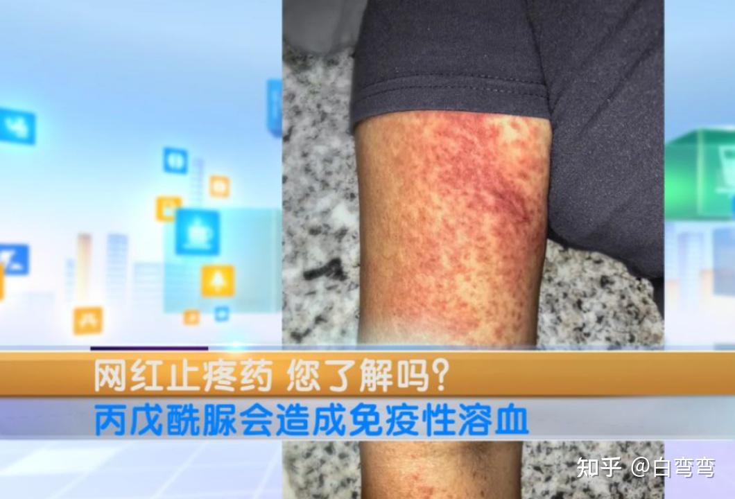 谋财害命的制药公司被曝光这是巨大丑闻的冰山一角