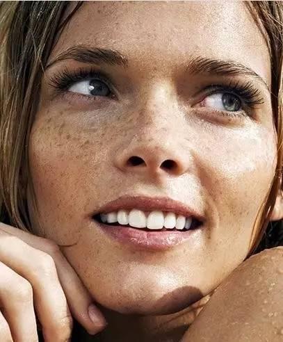 她体型消瘦,面色晦暗粗糙,脸上有大量的痘坑,每次来月经都等于受刑