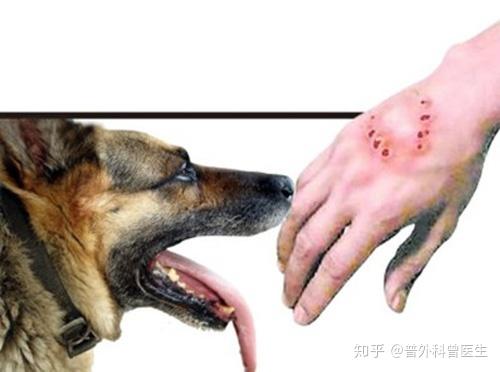 被猫和狗咬伤都需要接种狂犬疫苗吗并不是的有两种情况不需要