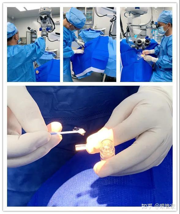 真实案例近视1000度到视力10icl晶体植入为我点亮清晰的世界