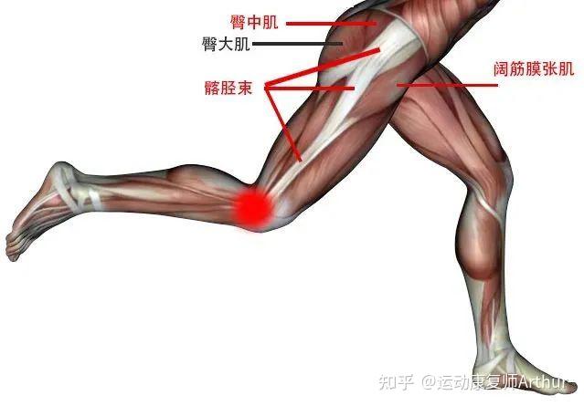 由于股骨外侧髁突起比较明显,当膝关节反复高强度屈伸时,位于股骨外侧
