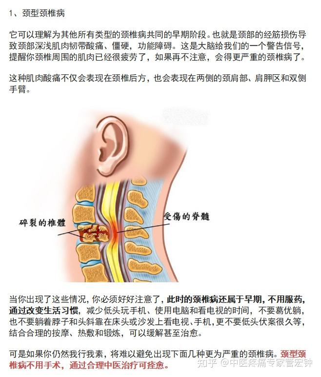 得了颈椎病到底是手术还是保守治疗