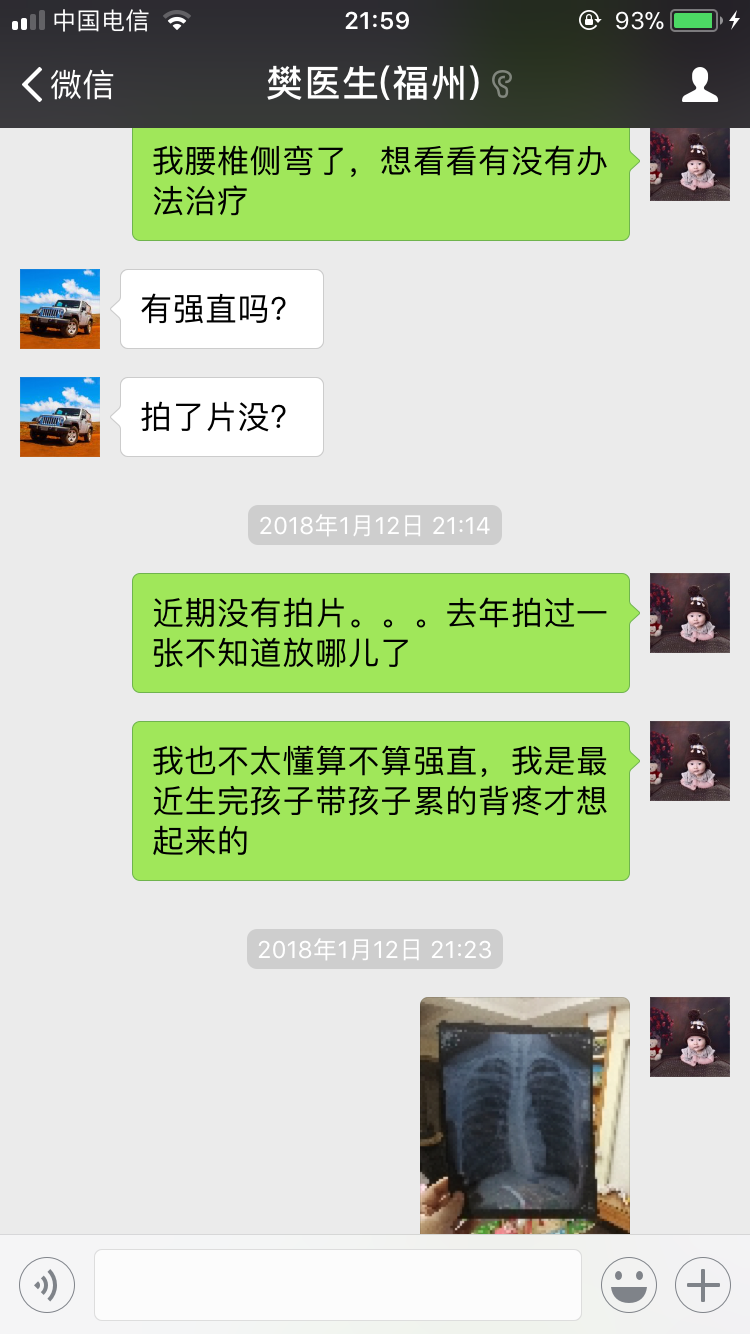 脊柱侧弯有什么适合做的恢复运动?