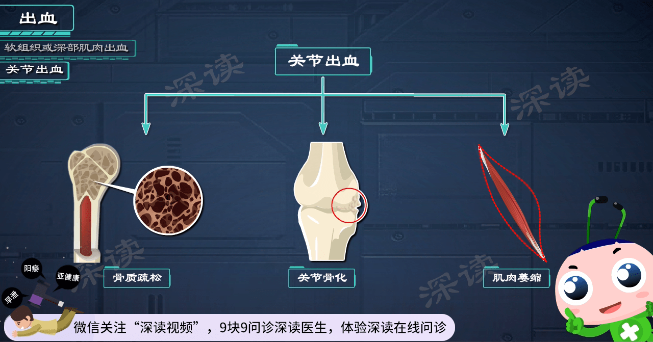 渾身上下一碰就出血出血難止住讓人脆弱不堪的血友病都有啥症狀