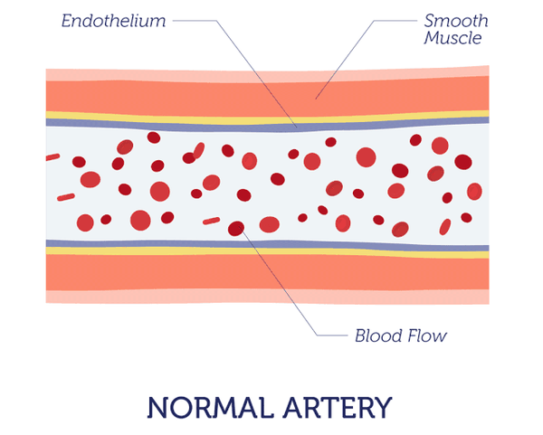 哪些疾病会导致动脉粥样硬化