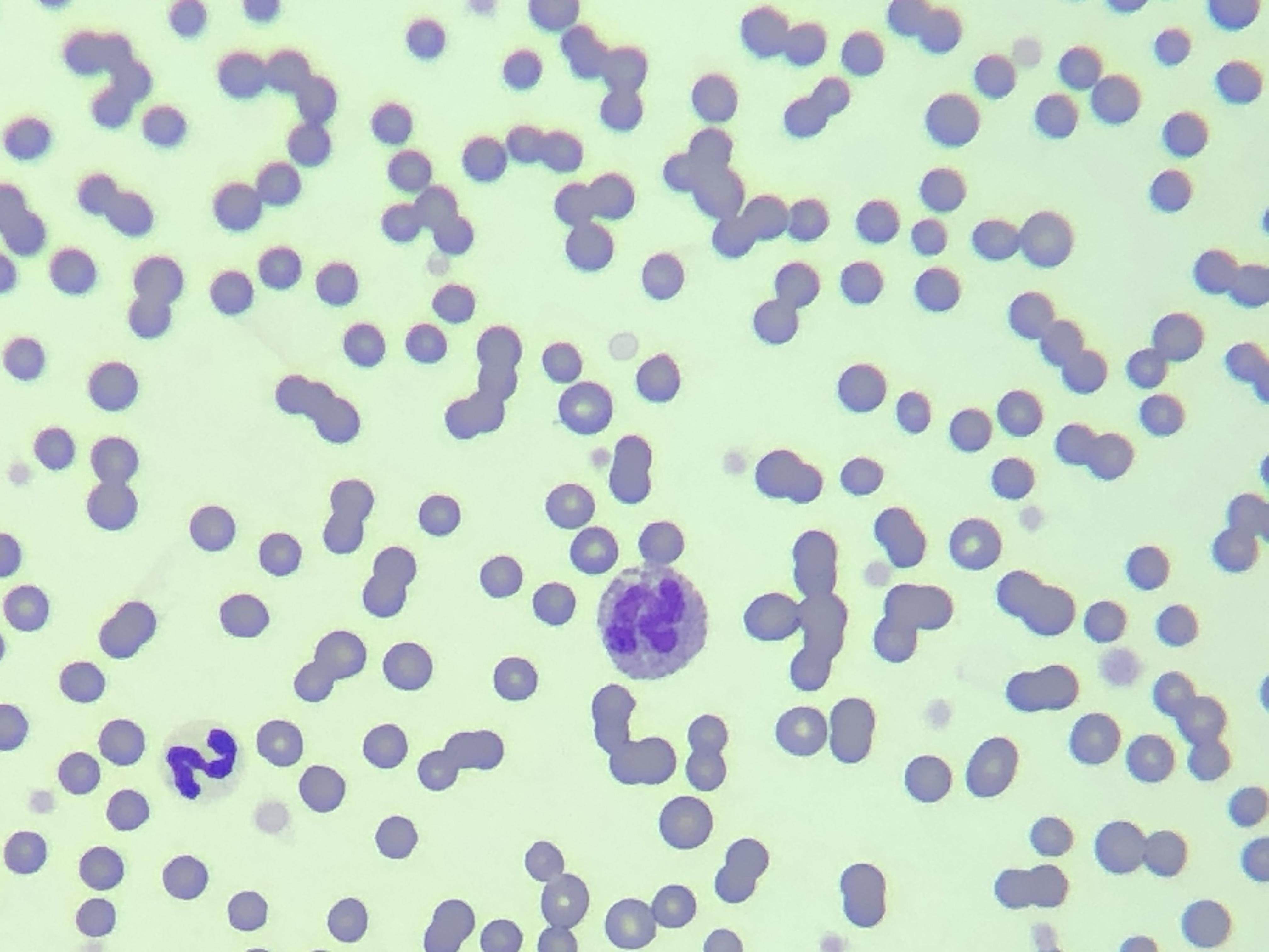 嗜碱性粒细胞 - 知乎