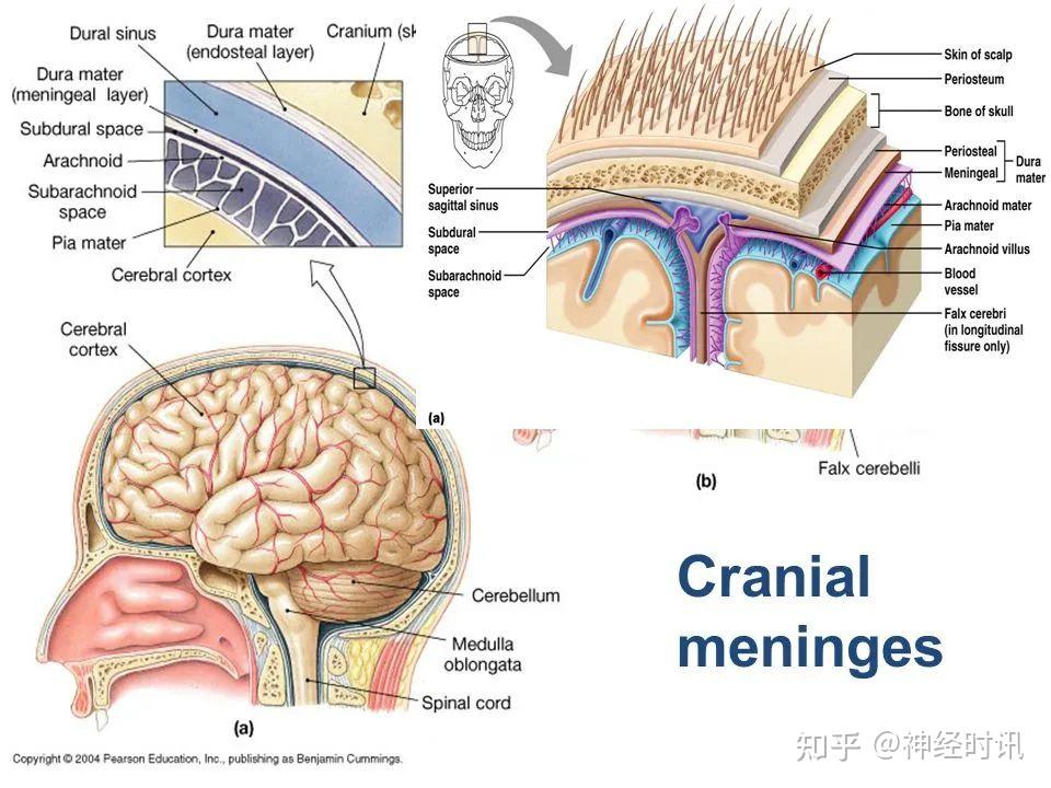 其中腦蛛網膜與軟腦膜之間的腔隙稱為蛛網膜下隙subarachnoid space