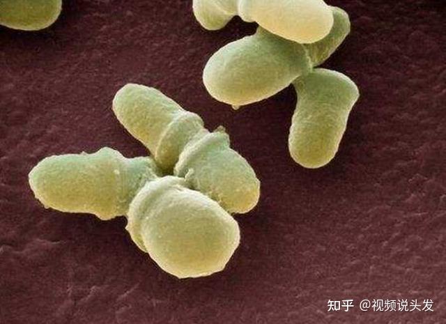 马拉色菌以头皮油脂为食而存活,其代谢物或裂解物会刺激头皮产生炎症