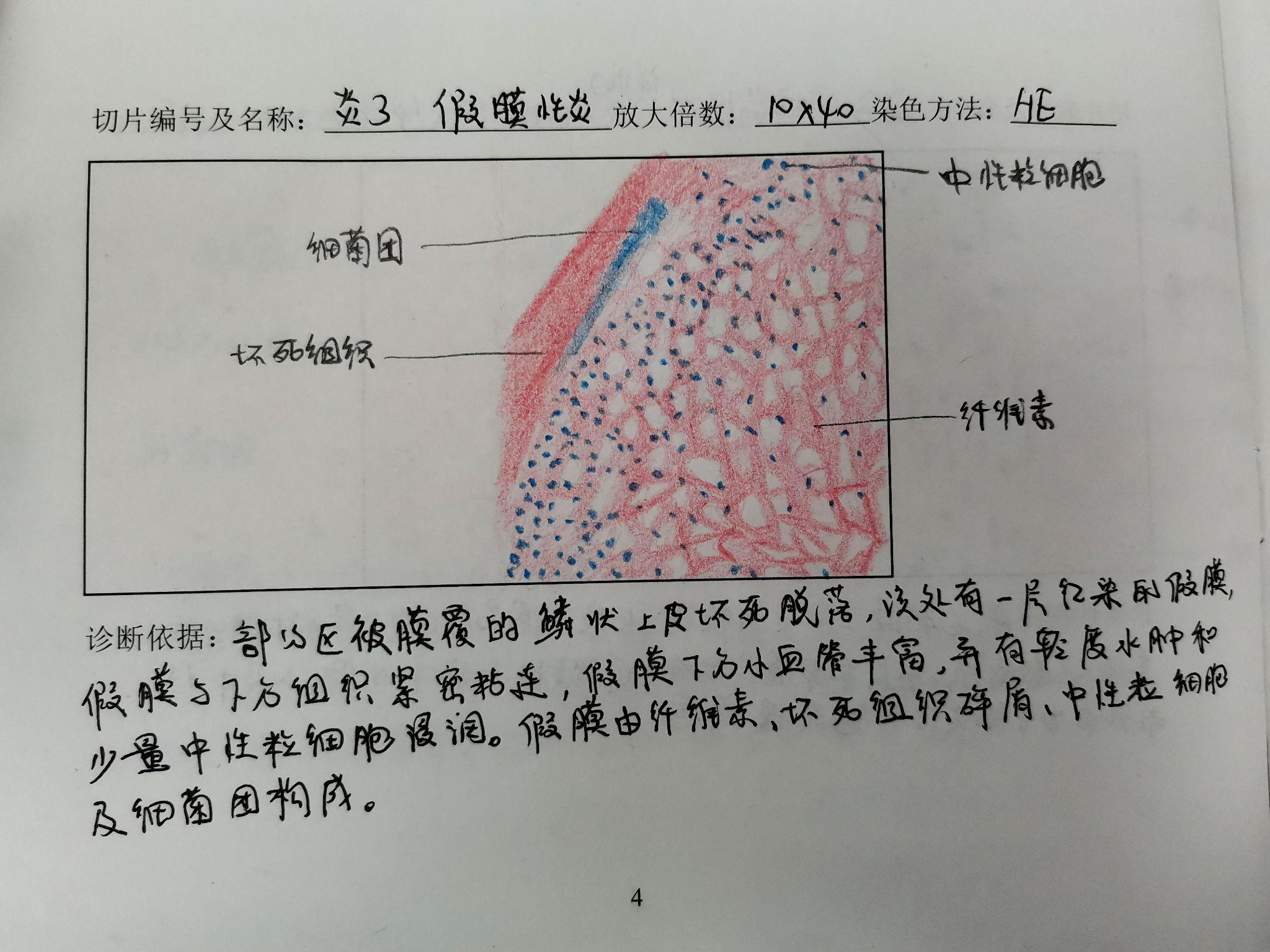 脾脏组织切片手绘图图片