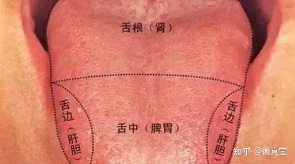 中医揭开舌诊的神秘面纱,带你一探神奇的舌诊,原来这么简单 - 知乎