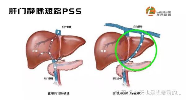 宠物肝门静脉分流的诊断与治疗 知乎