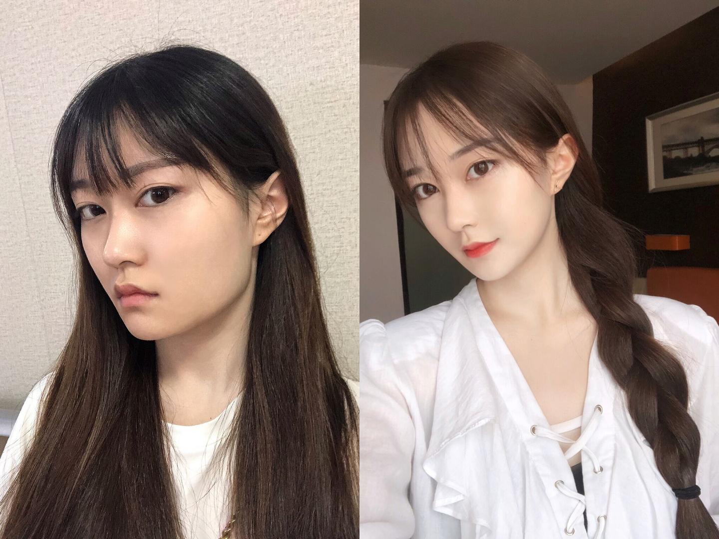 做整形削骨磨骨需要多少钱 知乎 做整形削骨磨骨需要多少钱 知乎