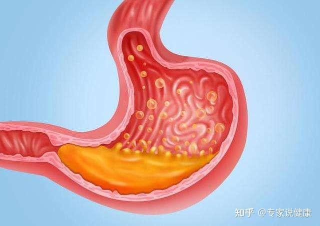 脾虛胃脹消化不良食慾差中醫健脾益氣助你消除胃脹氣