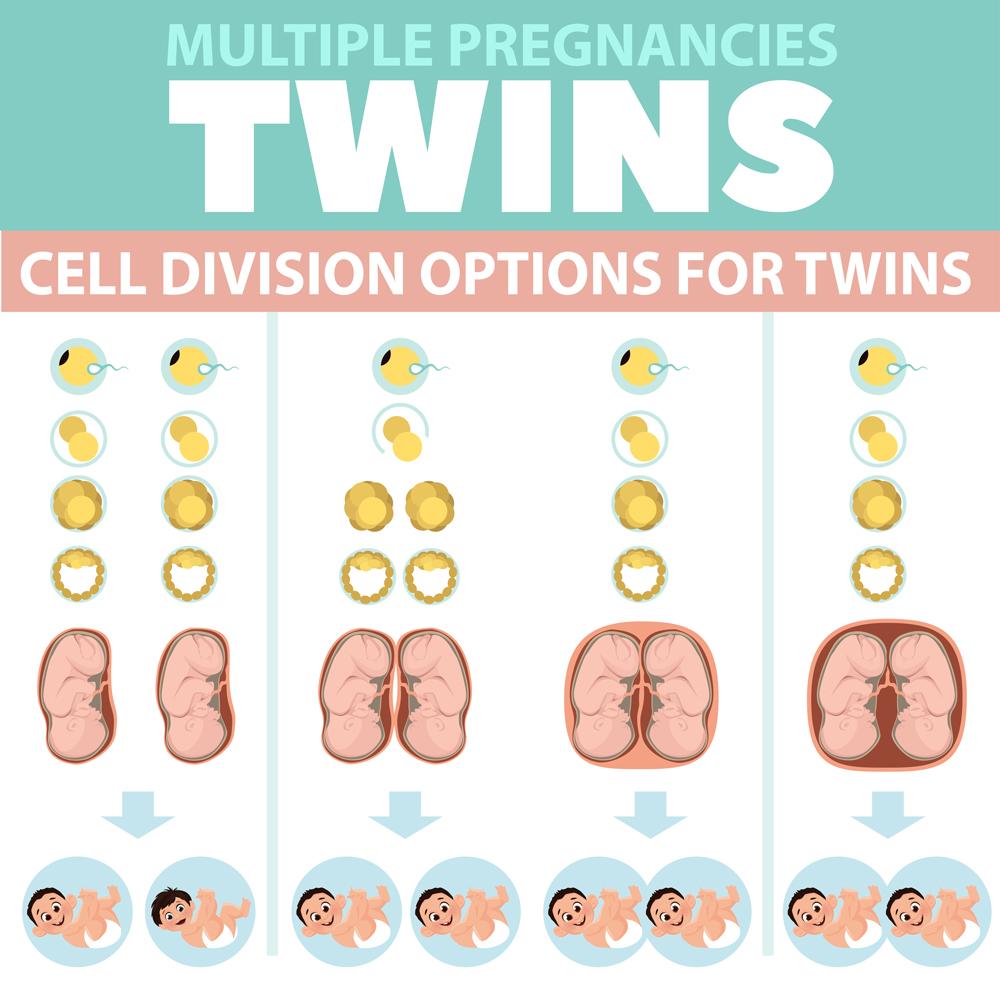 生育双胞胎的风险