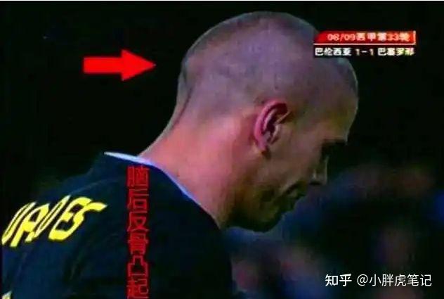按照通俗的说法, 脑勺平的人多是顺民, 后脑勺有" 反骨" 的人大都有